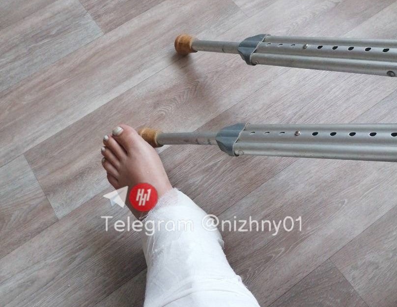 Соцсети: нижегородка сломала ногу на гнилой ступени в троллейбусе
