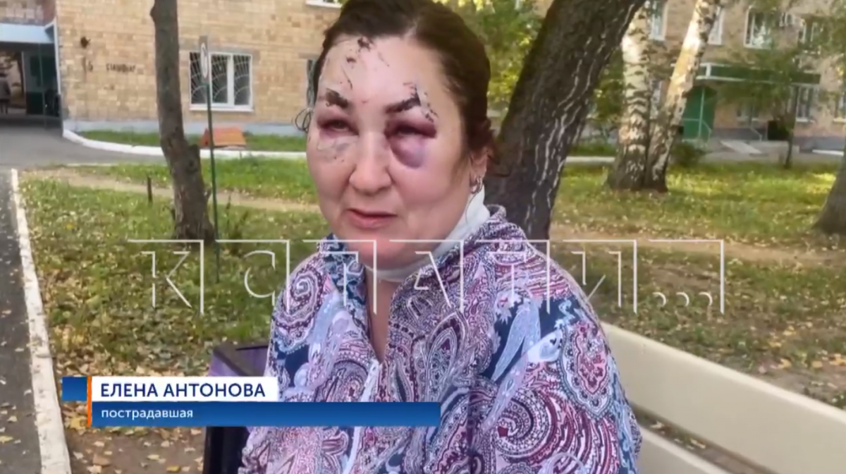 Прокуратура и СК заинтересовались нападением собаки на женщину в Кстове - фото 1